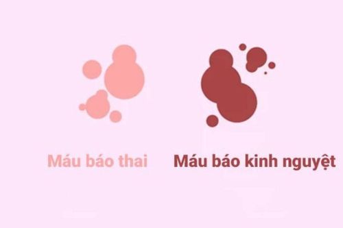 Máu báo thai - Thời lượng xuất hiện ngắn Máu báo thai - Thời lượng xuất hiện ngắn