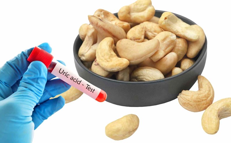 Hạt Điều - Thành phần dưỡng chất cốt lõi Hạt Điều - Thành phần dưỡng chất cốt lõi